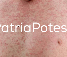 Patria potestà